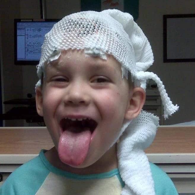 Colten Polyniak with gauze and wires attached to his head during his first EEG procedure.